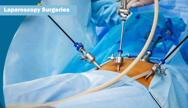 Hystro Laparoscopy Surgery
