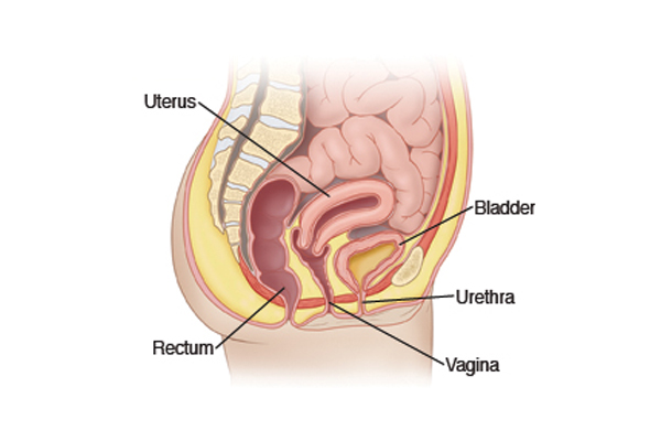 Utreus Removal (Hystrectomy)	